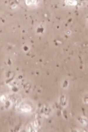 Bacteria: Friend and Foe
