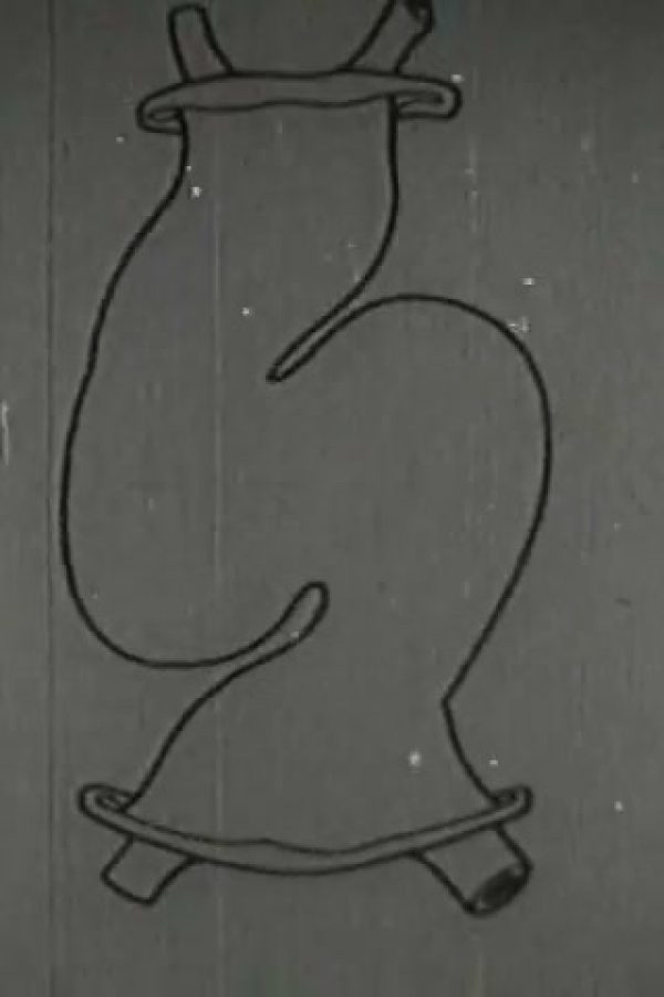 Heart, The