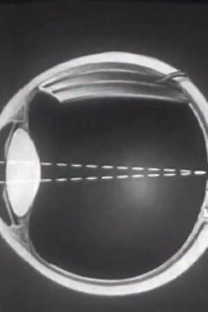 Eyes and Their Care (An Introduction), The
