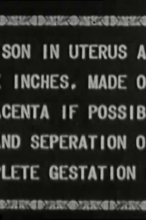 Childbirth with Caesarian Operation (Filmed in a Hospital)